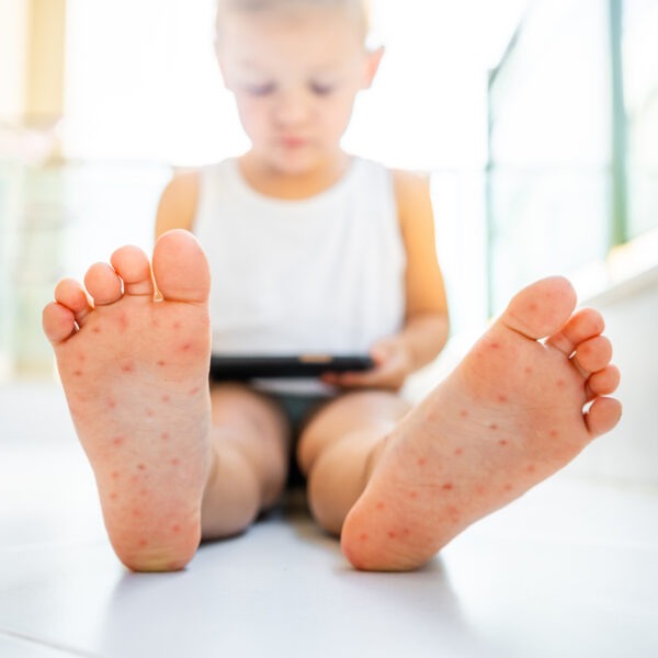Kinderreisepass adé: Alles, was du zum elektronischen Reisepass für Kinder wissen musst