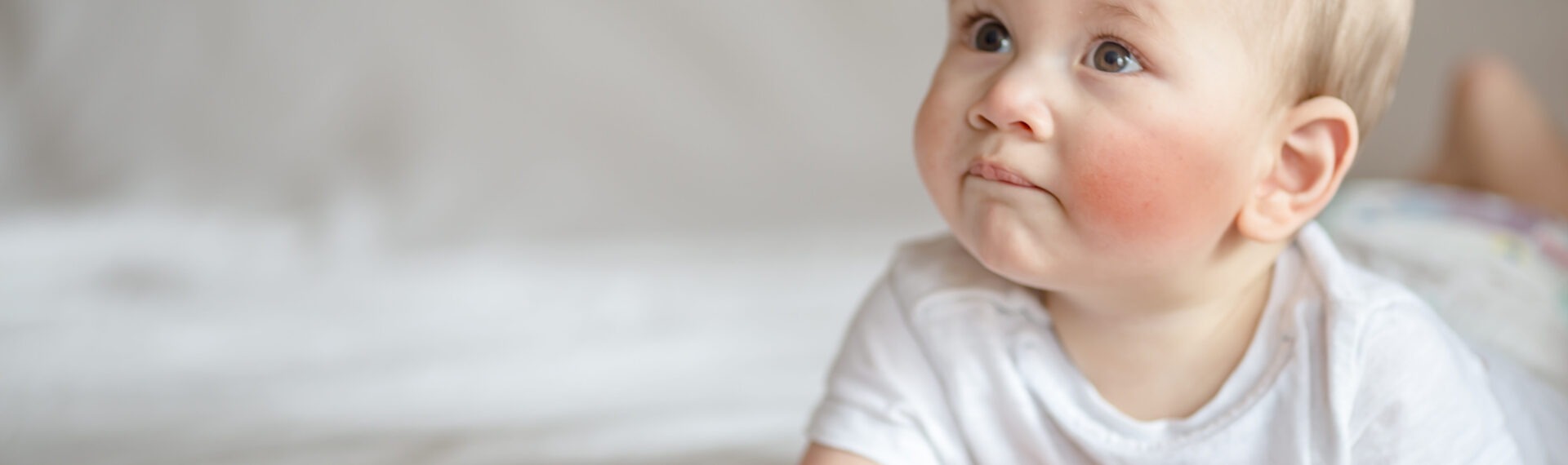 Ein Baby sitz auf einen weißen Bett. Es hat sichtbar rote Bäckchen vom Zahnen.